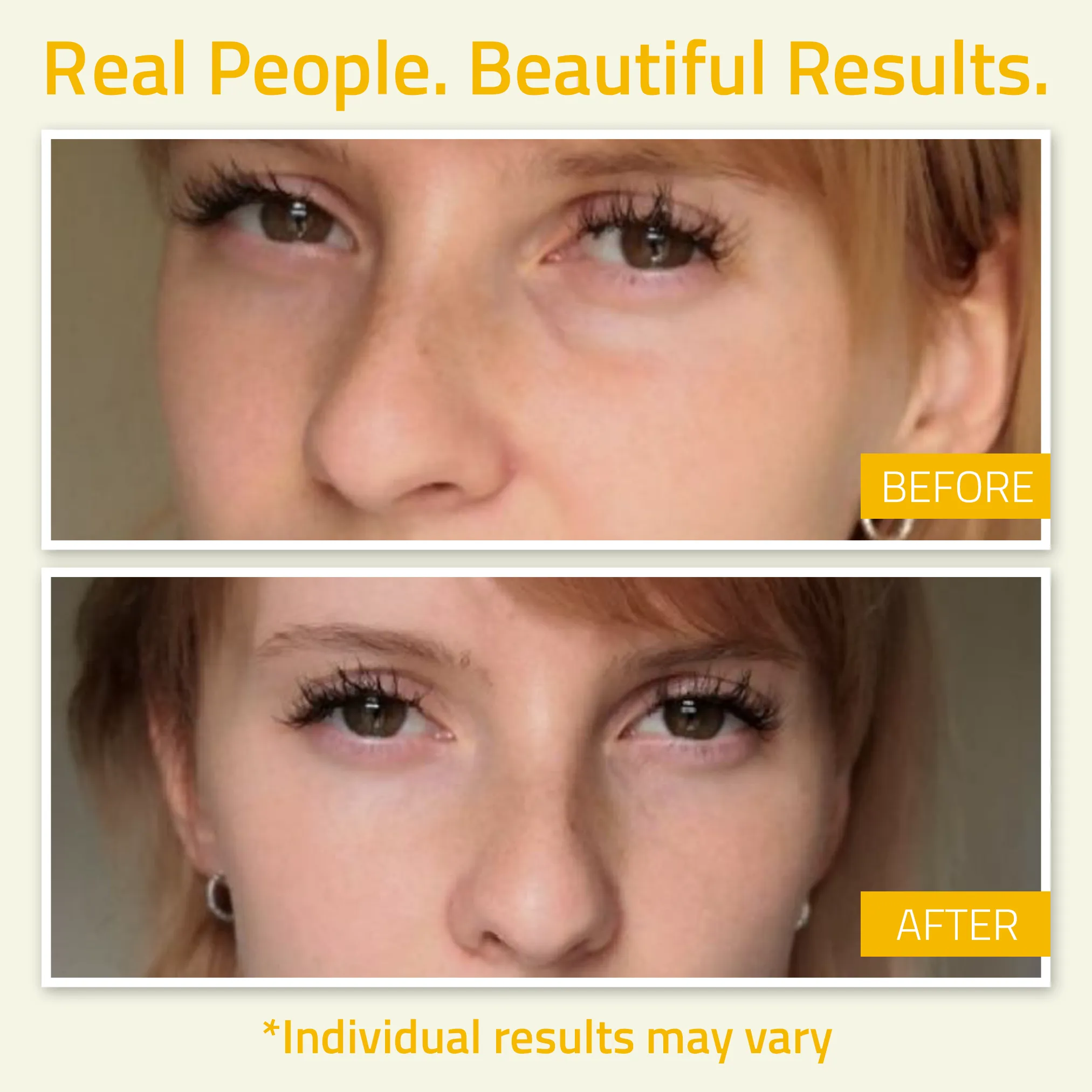 Radiance Eye Gel